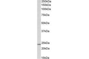 AP31709PU-N (0. (TIMP1 antibody  (Internal Region))