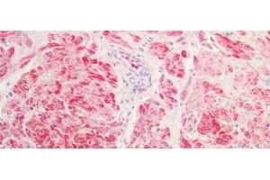 Immunohistochemistry (IHC) image for anti-Kallikrein-Related Peptidase 4 (KLK4) (AA 32-256) antibody (ABIN7431809)