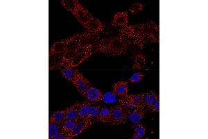 Confocal immunofluorescence analysis of A-431 cells using RPL21 antibody (ABIN7269996) at dilution of 1:100. (RPL21 antibody  (AA 1-160))