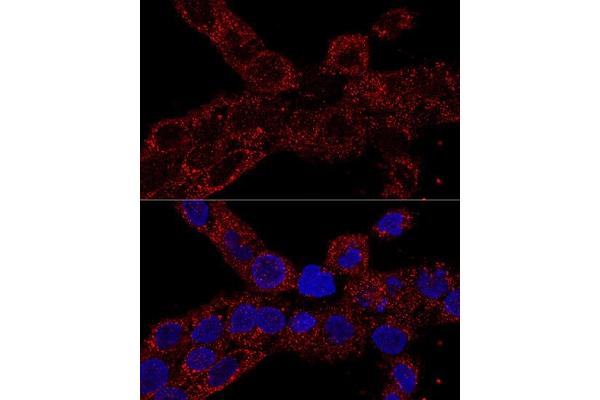RPL21 antibody  (AA 1-160)