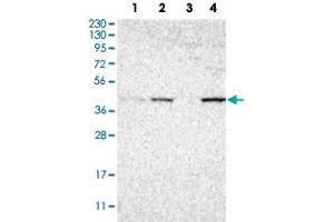 Western Blot analysis of Lane 1: RT-4 cell, Lane 2: U-251 MG sp cell, Lane 3: human plasma tissue (IgG/HSA depleted) and Lane 4: human liver tissue lysates with ACADM polyclonal antibody . (Medium-Chain Specific Acyl-CoA Dehydrogenase, Mitochondrial antibody)