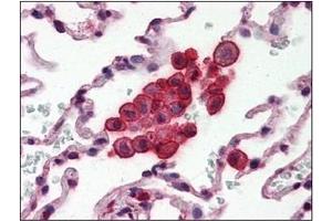 Immunohistochemistry (IHC) image for anti-Clusterin (CLU) (AA 1-333), (N-Term) antibody (ABIN317504) (Clusterin antibody  (N-Term))