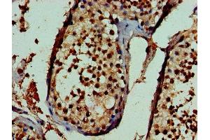 Immunohistochemistry of paraffin-embedded human testis tissue using ABIN7169424 at dilution of 1:100 (ASH2L antibody  (AA 1-534))