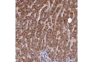 Immunohistochemical staining of human liver with FAM186B polyclonal antibody  shows strong cytoplasmic positivity in hepatocytes at 1:50-1:200 dilution.