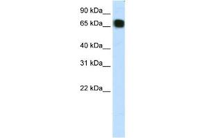 WB Suggested Anti-ZFP64 Antibody Titration:  1. (ZFP64 antibody  (C-Term))