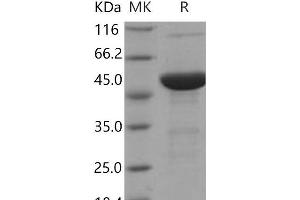 Western Blotting (WB) image for S100 Calcium Binding Protein A7A (S100A7A) protein (His tag,MBP tag) (ABIN7320360) (S100A7A Protein (His tag,MBP tag))