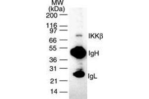 Image no. 2 for anti-Inhibitor of kappa Light Polypeptide Gene Enhancer in B-Cells, Kinase beta (IKBKB) antibody (ABIN208072)