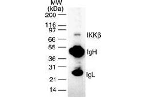 Image no. 2 for anti-Inhibitor of kappa Light Polypeptide Gene Enhancer in B-Cells, Kinase beta (IKBKB) antibody (ABIN208072) (IKBKB antibody)