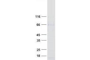 WD and Tetratricopeptide Repeats 1 (Wdtc1) protein (Myc-DYKDDDDK Tag)