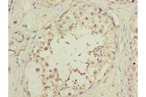 Immunohistochemistry of paraffin-embedded human testis tissue using ABIN7162226 at dilution of 1:100 (PLAC1L antibody  (AA 74-158))