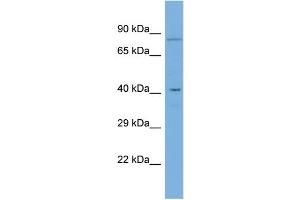 Host:  Rabbit  Target Name:  GDPD5  Sample Type:  COLO205 Whole Cell lysates  Antibody Dilution:  1. (GDPD5 antibody  (Middle Region))
