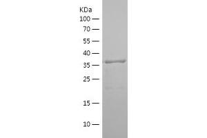 Western Blotting (WB) image for Peroxisome Proliferator-Activated Receptor gamma (PPARG) (AA 1-129) protein (His-IF2DI Tag) (ABIN7282757) (PPARG Protein (AA 1-129) (His-IF2DI Tag))
