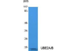 Western Blotting (WB) image for anti-UBE2A/B (C-Term) antibody (ABIN3180974) (UBE2A/B (C-Term) antibody)