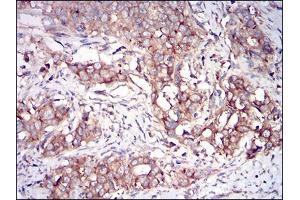 Immunohistochemistry (IHC) image for anti-Eukaryotic Translation Initiation Factor 2-alpha Kinase 2 (EIF2AK2) (AA 329-551) antibody (ABIN2682988)