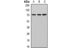 Western blot analysis of CKAP4 expression in HepG2 (A), MCF7 (B), mouse testis (C) whole cell lysates. (CKAP4 antibody)