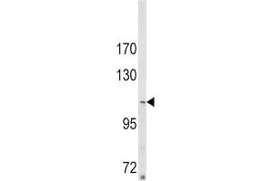 Western Blotting (WB) image for anti-Sorbin and SH3 Domain Containing 2 (Sorbs2) antibody (ABIN3002919) (Sorbs2 antibody)