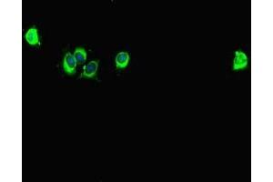 Immunofluorescent analysis of Hela cells using ABIN7146024 at dilution of 1:100 and Alexa Fluor 488-congugated AffiniPure Goat Anti-Rabbit IgG(H+L) (SPAG9 antibody  (N-Term))