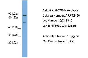 WB Suggested Anti-CRNN Antibody   Titration: 1. (CRNN antibody  (Middle Region))