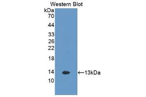 Western blot analysis of the recombinant protein. (CXCL1 antibody  (AA 25-96))