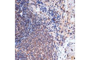 Immunohistochemistry of paraffin-embedded rat spleen using FNTB Rabbit mAb (ABIN1680761, ABIN3016316, ABIN3016317 and ABIN7101479) at dilution of 1:100 (40x lens). (FNTB antibody)