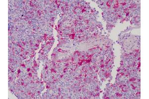 Anti-Gelsolin antibody IHC of human tonsil. (Gelsolin antibody  (AA 161-369))