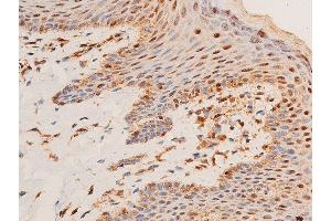Immunohistochemistry (IHC) image for anti-Checkpoint Kinase 1 (CHEK1) (pSer296) antibody (ABIN6256251)