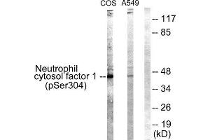 Western Blotting (WB) image for anti-Neutrophil Cytosol Factor 1 (NCF1) (pSer304) antibody (ABIN1847418) (NCF1 antibody  (pSer304))