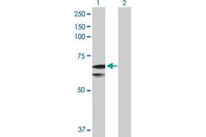 Western Blot analysis of SLC27A1 expression in transfected 293T cell line by SLC27A1 MaxPab polyclonal antibody. (SLC27A1 antibody  (AA 1-646))