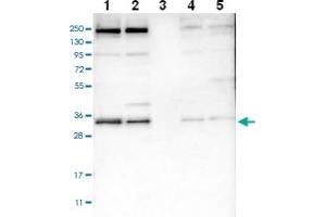 Western blot analysis of Lane 1: RT-4 Lane 2: U-251 MG Lane 3: Human Plasma Lane 4: Liver Lane 5: Tonsil with SYF2 polyclonal antibody .