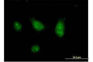 Immunofluorescence of purified MaxPab antibody to CISH on HeLa cell. (CISH antibody  (AA 1-258))
