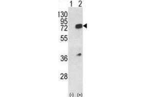 Western Blotting (WB) image for anti-Heterogeneous Nuclear Ribonucleoprotein L (HNRNPL) antibody (ABIN3001739)