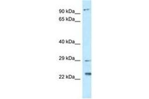 Image no. 1 for anti-Chromosome 17 Open Reading Frame 70 (C17ORF70) (AA 92-141) antibody (ABIN6747793)