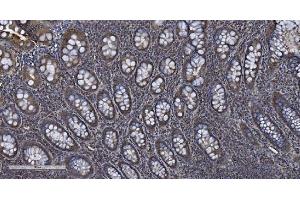 IHC analysis of MIEF1 using anti-MIEF1 antibody (ABIN7600396). (SMCR7L antibody  (AA 189-463))
