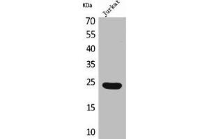 Western Blot analysis of Jurkat cells using IFN-ε Polyclonal Antibody (IFNE antibody  (C-Term))