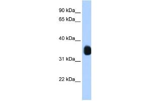 WB Suggested Anti-MLX Antibody Titration:  1.