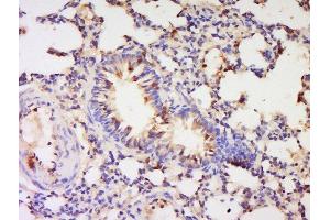 Formalin-fixed and paraffin embedded rat lung labeled with Anti-PBEF1 Polyclonal Antibody, Unconjugated  at 1:200 followed by conjugation to the secondary antibody and DAB staining. (NAMPT antibody  (AA 301-400))