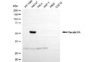 Western blotting analysis using keratin 6A antibody (ABIN7799182).