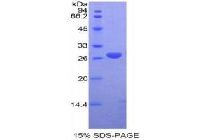 SDS-PAGE (SDS) image for Glutathione S-Transferase mu 1 (GSTM1) (AA 1-218) protein (His tag) (ABIN1525428) (GSTM1 Protein (AA 1-218) (His tag))