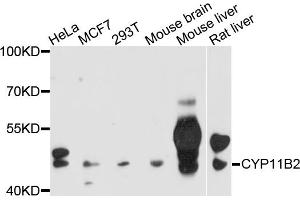 Western blot analysis of extracts of various cell lines, using CYP11B2 antibody (ABIN4903422) at 1:1000 dilution. (CYP11B2 antibody)