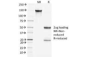 SDS-PAGE Analysis Purified Clathrin, HC Monoclonal Antibody (CHC/1432). (Clathrin Heavy Chain (CLTC) antibody)
