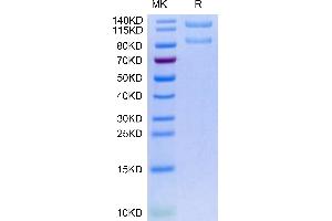 Human ITGAX&ITGB2 on Tris-Bis PAGE under reduced condition. (Integrin alpha X beta 2 (ITGAX & ITGB2) Heterodimer (AA 20-1107) protein (His tag))