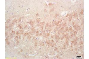 Formalin-fixed and paraffin embedded rat brain labeled with Rabbit Anti PAK7/PAK5/MBT Polyclonal Antibody, Unconjugated (ABIN671496) at 1:200 followed by conjugation to the secondary antibody and DAB staining (PAK7 antibody  (AA 621-719))