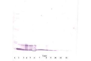 Image no. 4 for anti-Chemokine (C-X-C Motif) Ligand 10 (CXCL10) antibody (ABIN465012) (CXCL10 antibody)