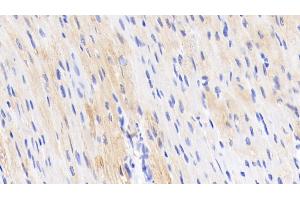 Detection of TNNT2 in Porcine Cardiac Muscle Tissue using Polyclonal Antibody to Troponin T Type 2, Cardiac (TNNT2) (Cardiac Troponin T2 antibody  (AA 56-271))