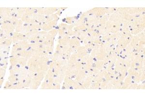 Immunohistochemistry (IHC) image for anti-Adenylate Cyclase 7 (Adcy7) (AA 309-491) antibody (ABIN7443068)