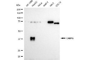 Western blotting analysis using C4BPB antibody (ABIN7798141).