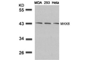 Image no. 3 for anti-Mitogen-Activated Protein Kinase Kinase 6 (MAP2K6) (AA 205-209) antibody (ABIN197355)