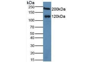 Detection of MGAM in Human Serum using Polyclonal Antibody to Maltase-glucoamylase (MGAM) (Maltase-Glucoamylase (MGAM) (AA 213-392) antibody)