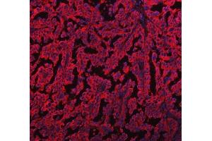 IF analysis of EML4 using anti-EML4 antibody (ABIN6719384). (EML4 antibody  (AA 207-423))