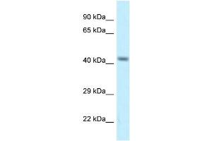 Western Blotting (WB) image for anti-Calcium Channel, Voltage-Dependent, gamma Subunit 8 (CACNG8) (Middle Region) antibody (ABIN2776261)